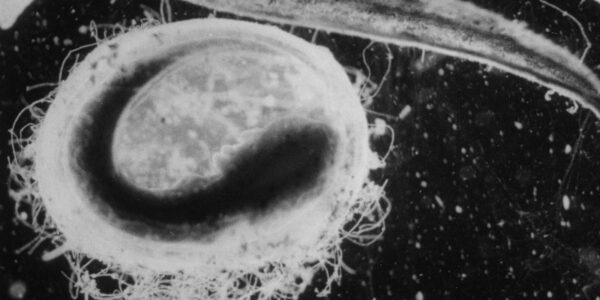 Close-up of a hairy underwater amoeba in black and white